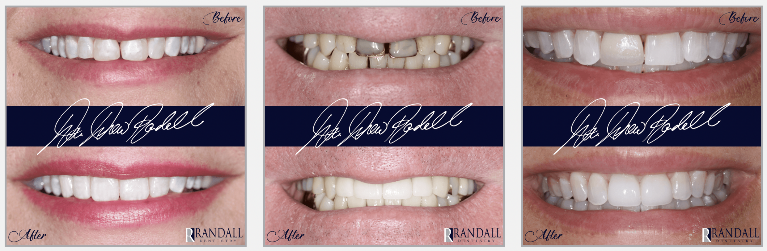 Screen Shot 2024-01-20 at 8.15.33 PM smile makeover university park tx