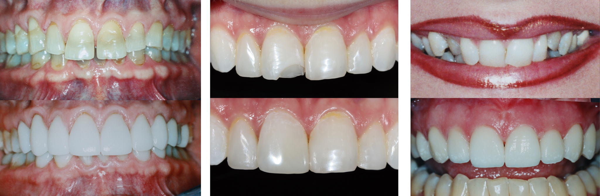 Untitled design (17) Invisalign university park tx