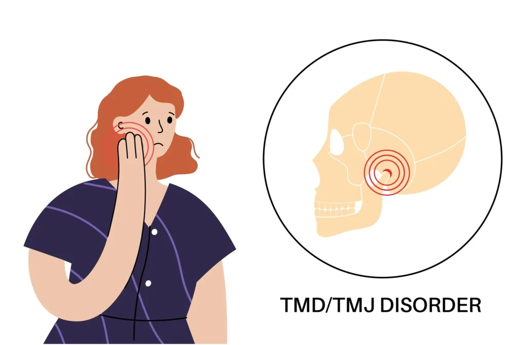 How Jaw Injuries Can Lead to TMJ Disorders