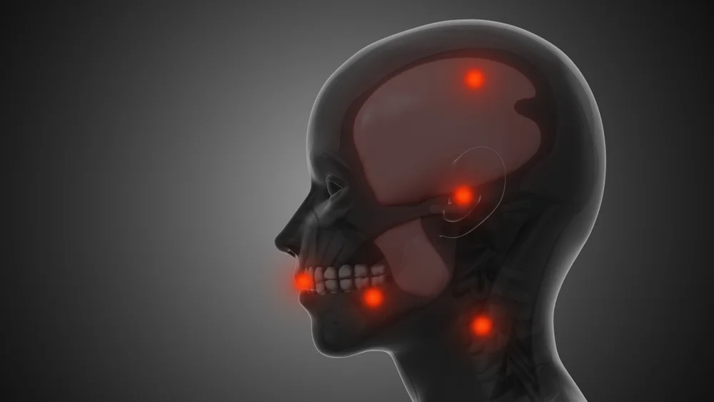 jaw arthritis